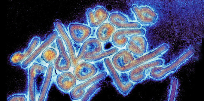 WHO, 에티오피아에서 첫 마르부르크(Marburg) 바이러스 발생